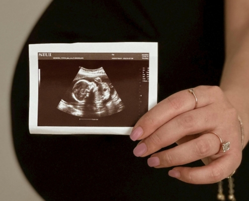 ultrasound closeup in front of pregnant woman